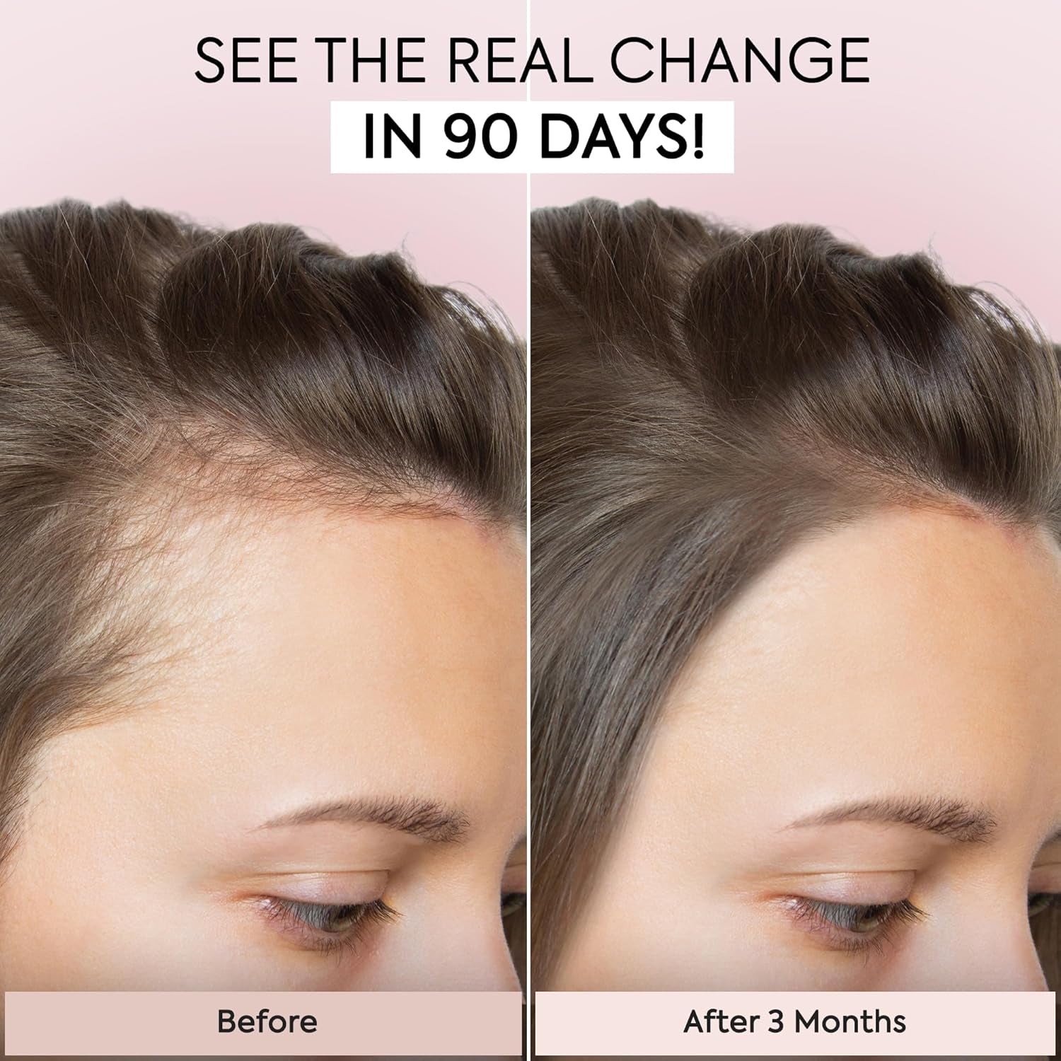 Hair Growth Serum: Veganic Natural Hair Growth Oil - Hair Loss Treatment for Women and Men - GRO Hair Serum for Thining Hair - Fuller Thicker and Healthier Hair in 90 Days, 1 Fl Oz